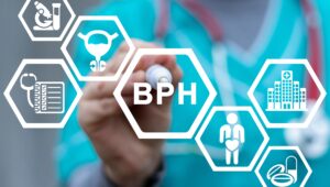 Benign Prostatic Hyperplasia (BPH) (Enlarged Prostate)