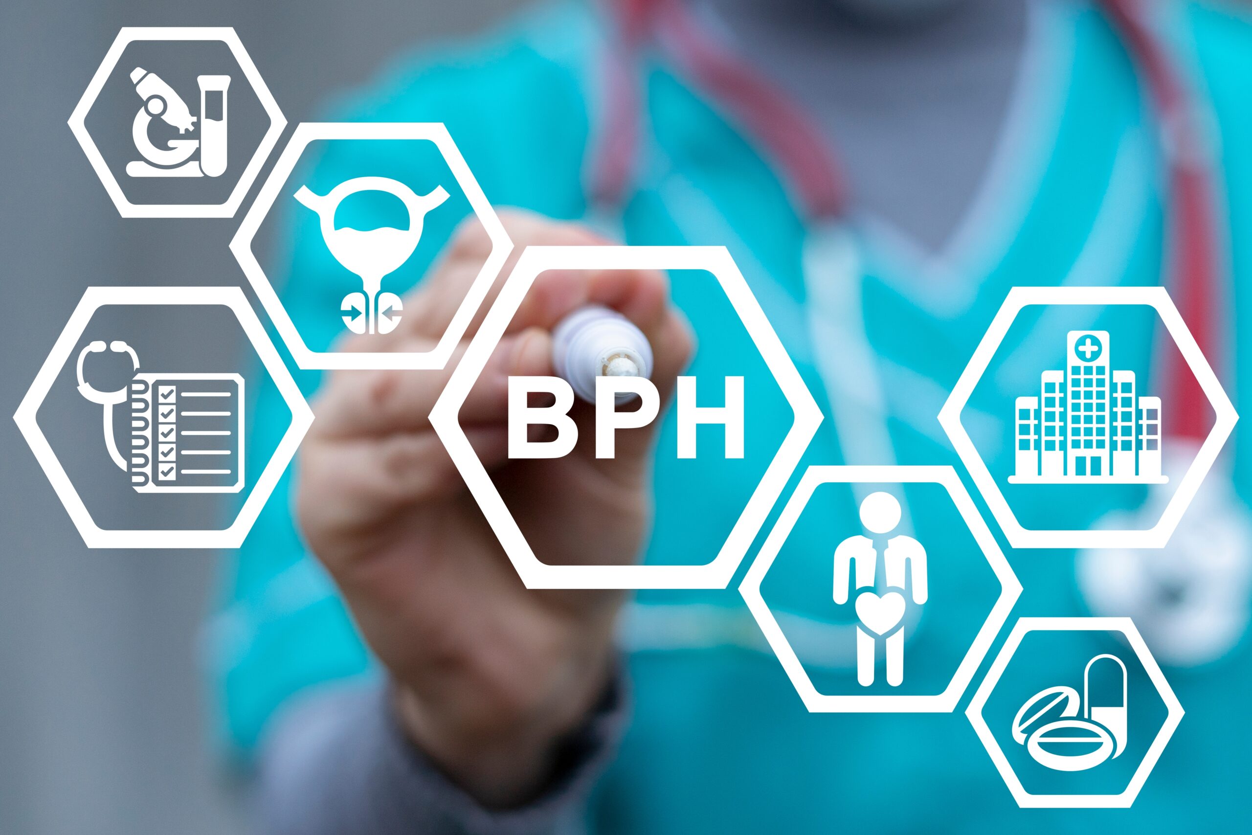 Understanding the Role of Prostate MRI in Beningn Prostatic Hyperplasia ...
